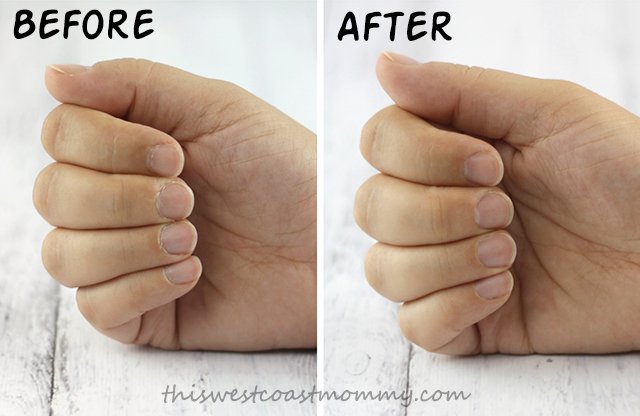 Before and After using the MICRO Pedi Manicure/Pedicure Extension Kit.
